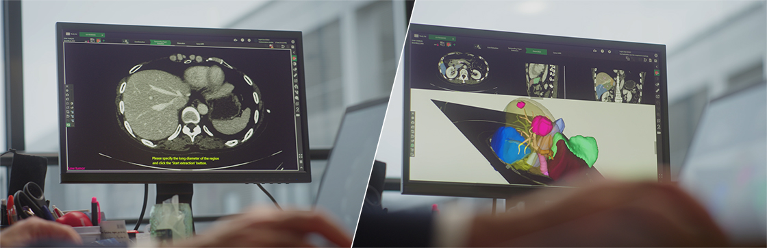 Monitor with CT image / Monitor with 3D CT image
